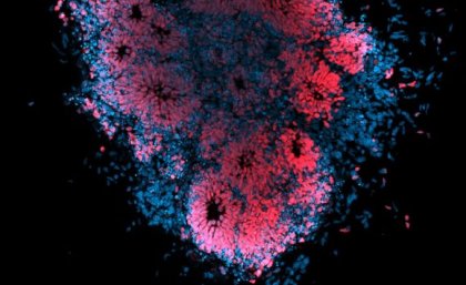 Microscopic image of human brain organoid infected with Zika virus. Image: Dr Julio Aguado (AIBN, UQ) clusters of pink dots surrounded by blue dots on a black background